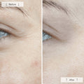 Omnilux Contour Face before and after results for wrinkle reduction using red light therapy mask.